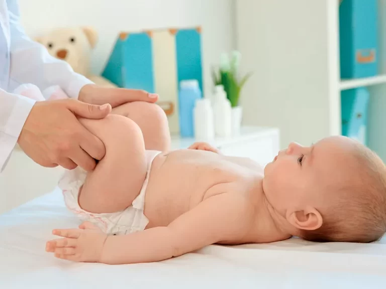 displasia do desenvolvimento da anca no bebé